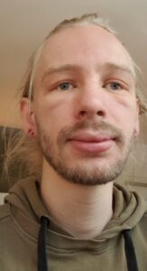 kambo froschgesicht